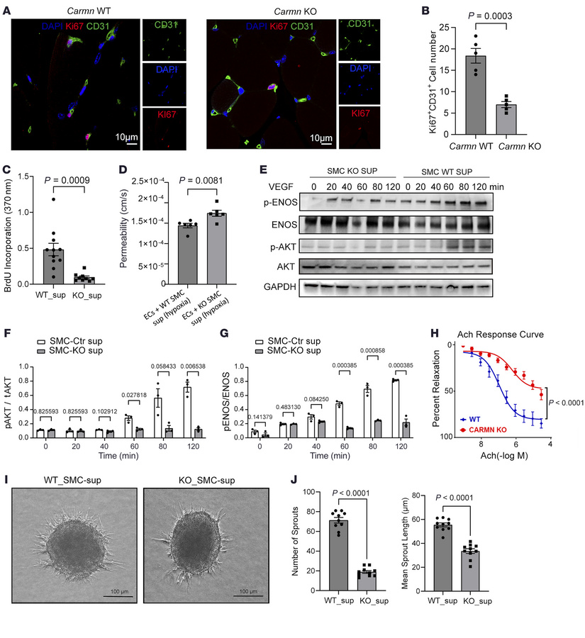 SMC-derived Carmn expression promotes EC proliferation and angiogenesis....