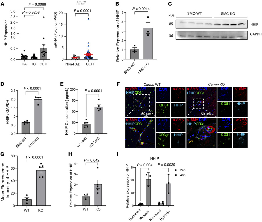
Carmn regulates Hhip expression in vitro and in vivo.
(A) Left, Normali...