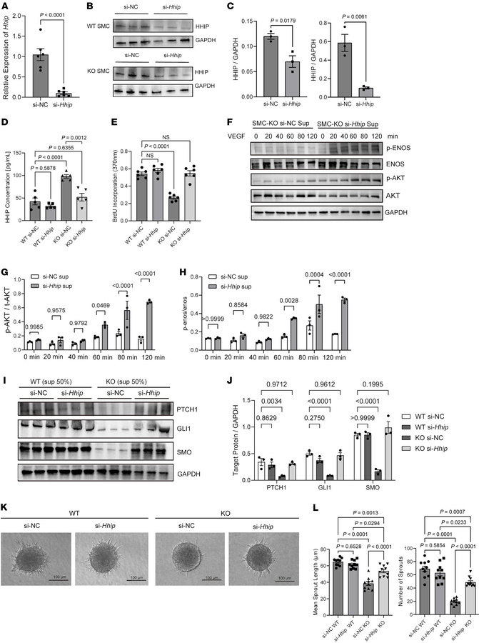
Hhip targets Hedgehog Signaling Pathway to mediate angiogenic changes i...