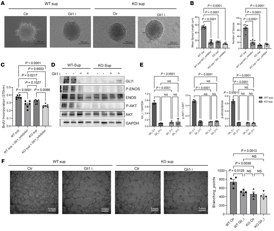 Inhibition of the Hedgehog signaling pathway in WT SMCs can phenocopy th...