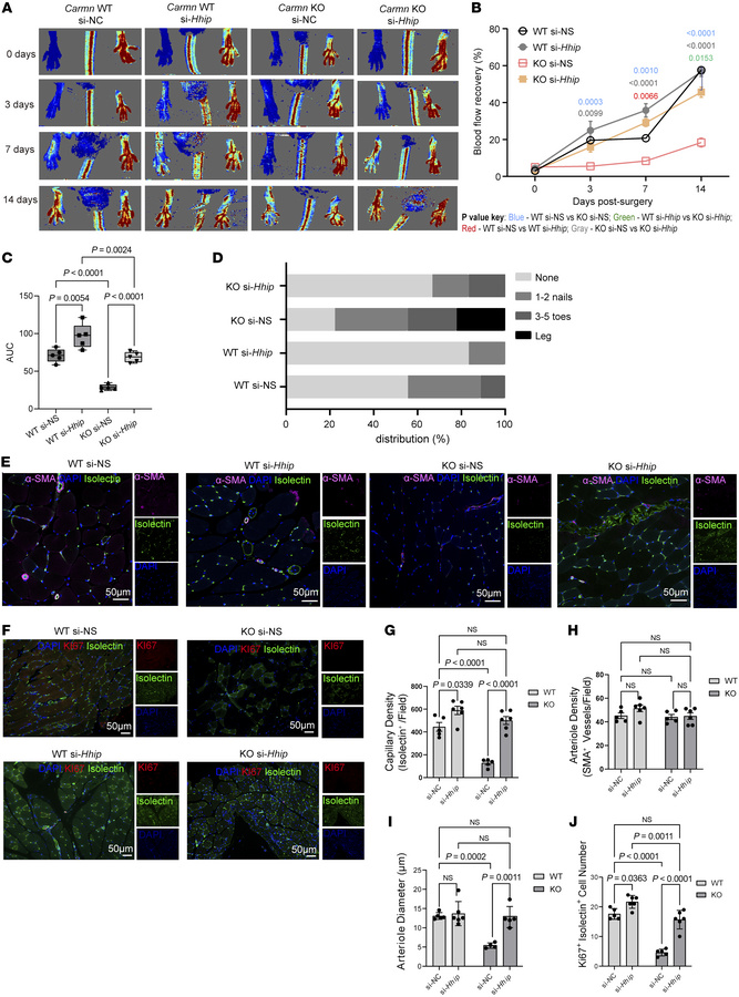 Delivery of siRNA targeting Hhip rescued revascularization in hindlimb i...