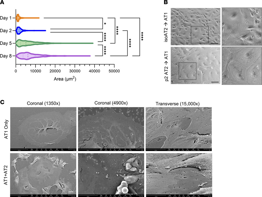 AT1s derived from expanded AT2s exhibit morphological changes.
(A) Violi...