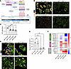 Three exogenous factors enable the expansion and stability of primary AT2s