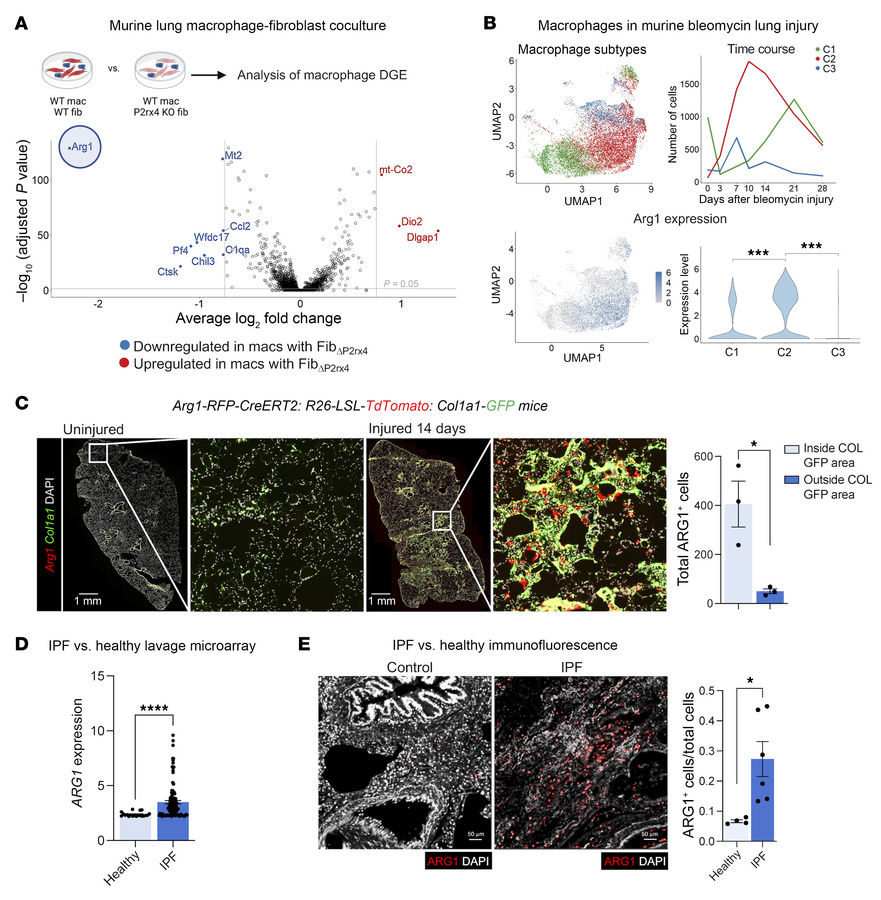 ARG1-expressing cells localize to the fibrotic niche in murine and human...