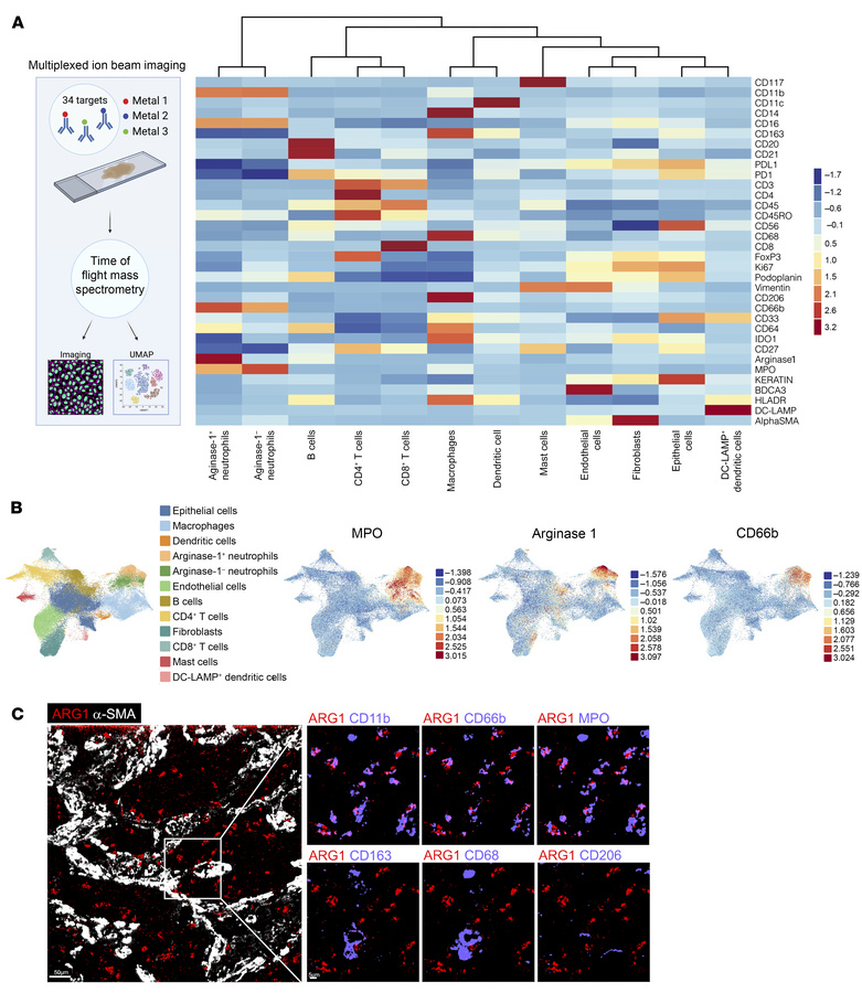 ARG1 is expressed predominantly by neutrophils in IPF.
(A) Schematic of ...
