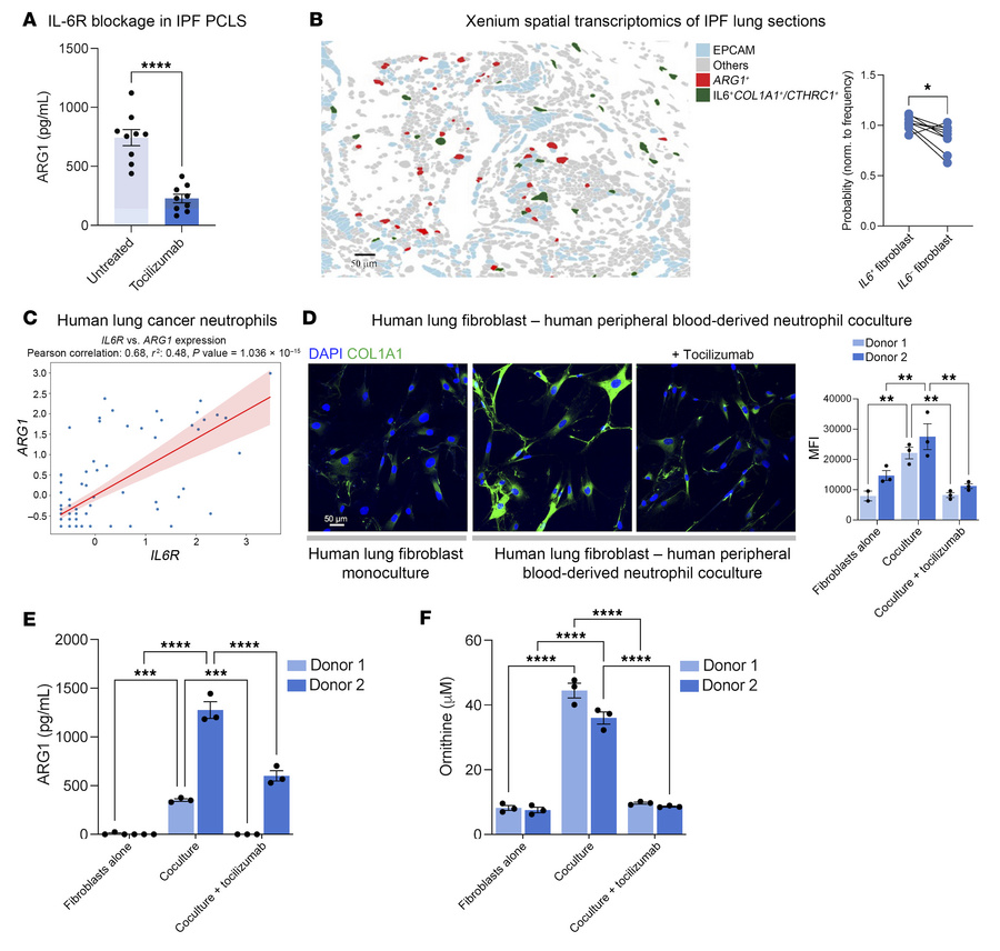 IL-6 is necessary for ARG1 expression in IPF lung and in cocultures of h...