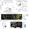 ARG1-expressing cells localize to the fibrotic niche in murine and human lu