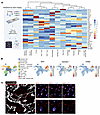 ARG1 is expressed predominantly by neutrophils in IPF.