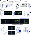 ARG1 regulates lung collagen via ornithine production.
