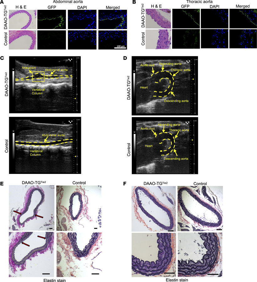 Imaging of the abdominal and thoracic aorta following chemogenetic oxida...