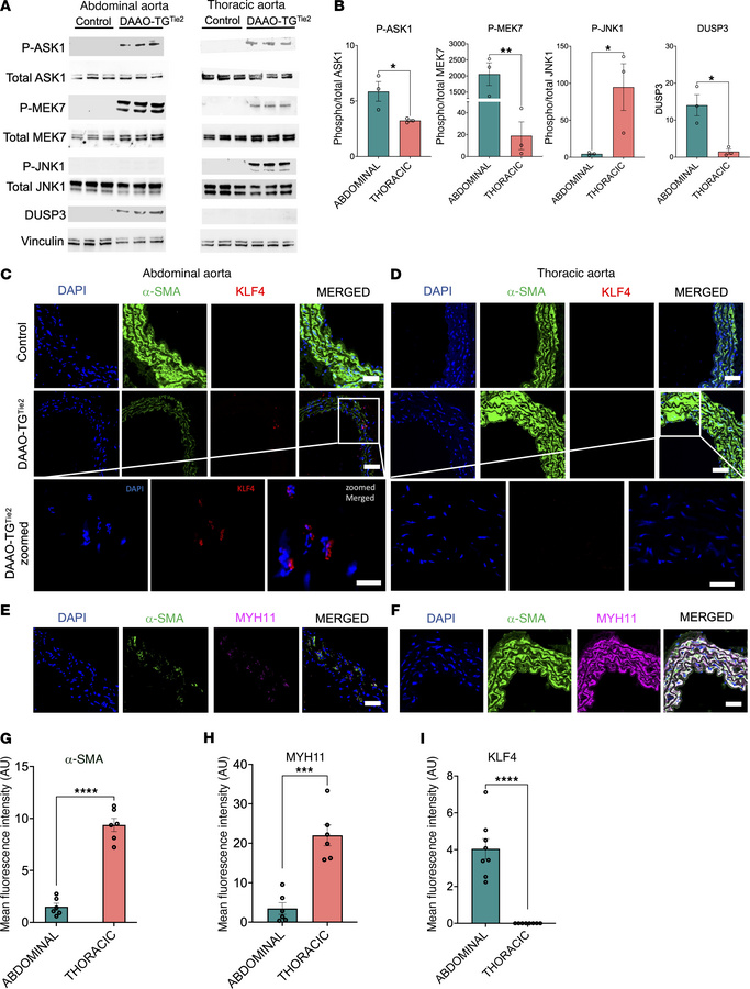 VSMC phenotypic switching in abdominal aorta but not in thoracic aorta.
...