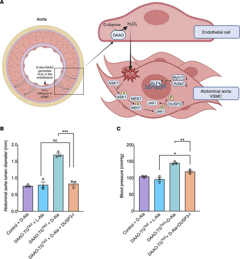 A key role for DUSP3 in abdominal aortic aneurysm formation caused by ox...