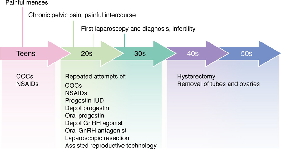 The clinical course of endometriosis over a lifetime.
The top row summar...
