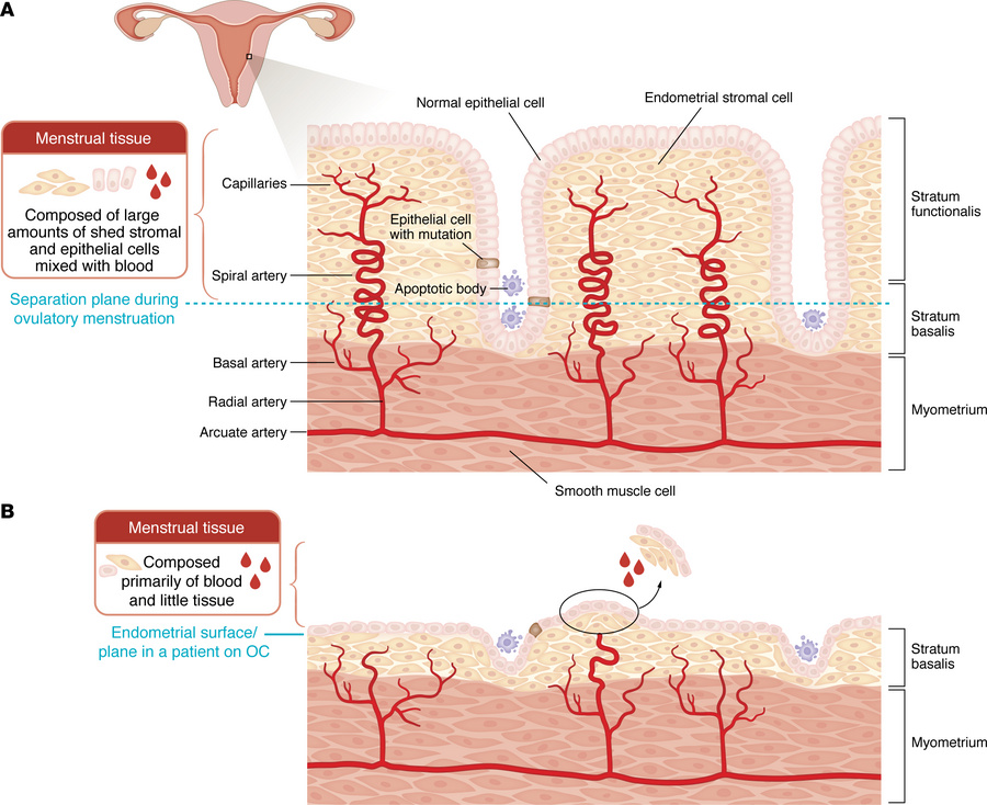 Not all forms of uterine bleeding increase the risk of endometriosis.
(A...