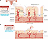 Not all forms of uterine bleeding increase the risk of endometriosis.