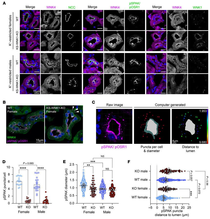 K+-restricted WT and KS-WNK1–KO mice exhibit sex differences in WNK body...