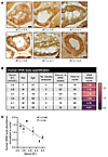 Human WNK body abundance correlates with serum [K+].