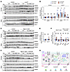 Dysregulated WNK4-SPAK/OSR1 pathway activity in KS-WNK1–KO mice during K+ r