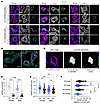 K+-restricted WT and KS-WNK1–KO mice exhibit sex differences in WNK body ex