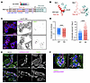 KS-WNK1 5Q mutant mice exhibit altered WNK body morphology and pSPAK locali