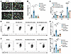 Tumoral RCOR2 impedes activation of intratumoral CD4+ and CD8+ T cells thro