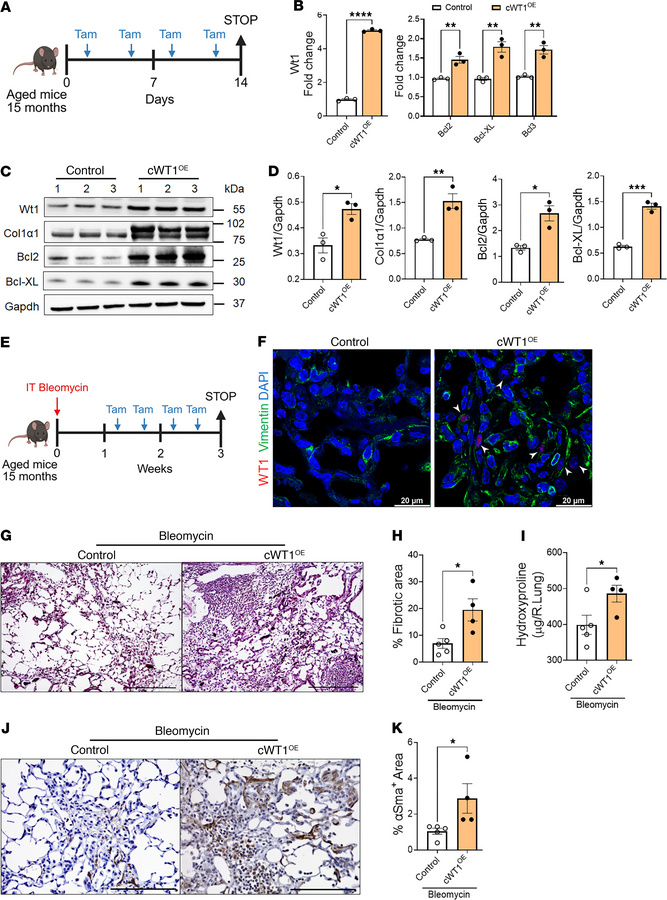 WT1 augments fibroblast survival and bleomycin-induced pulmonary fibrosi...