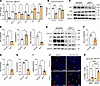Loss of WT1 attenuates the expression of genes involved in fibroblast survi