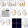 WT1 functions as a positive regulator of lung-resident fibroblast survival.
