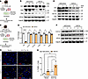 Overexpression of WT1 augments prosurvival gene expression in mouse lung re