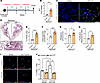 Fibroblast-specific WT1 overexpression augments bleomycin-induced pulmonary