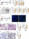 WT1 augments fibroblast survival and bleomycin-induced pulmonary fibrosis i