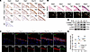 Collagen VII increased from early stage during pleural fibrotic process.