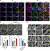Excessive collagen VII induced collagen I linearization.