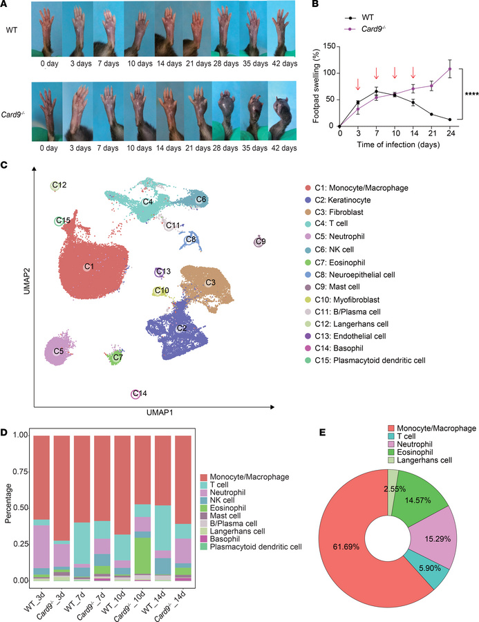 CARD9 is necessary for defense against subcutaneous dematiaceous fungal ...