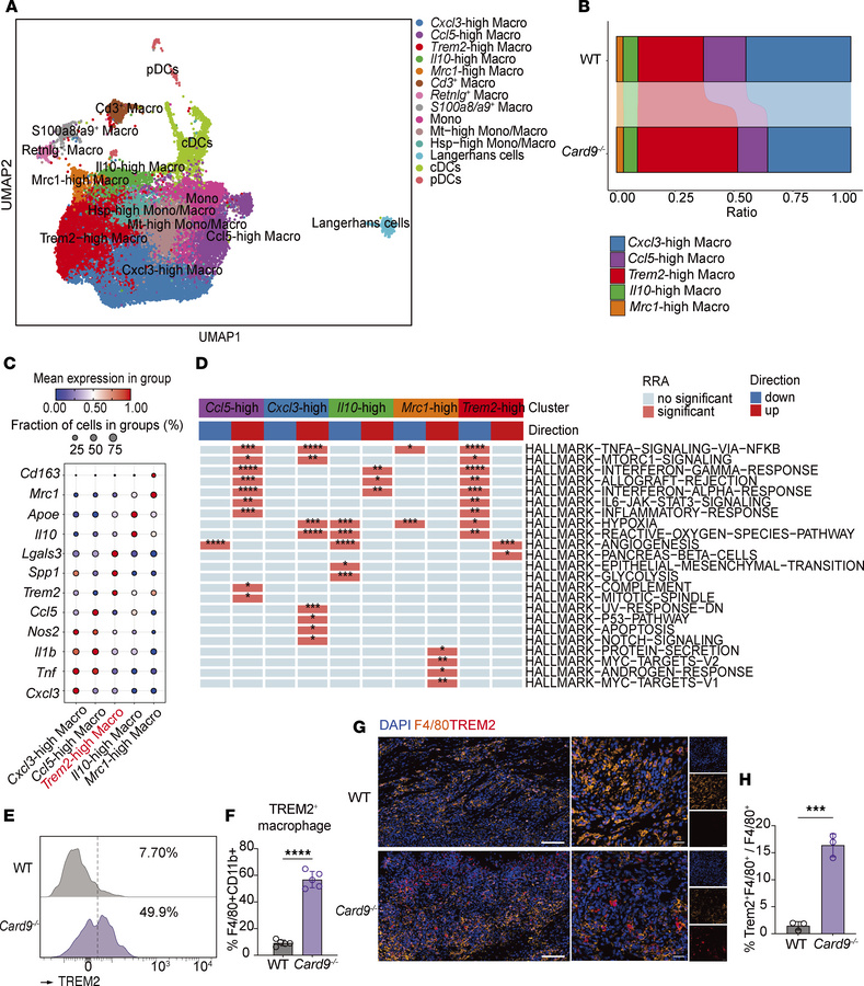 TREM2hi macrophages display antiinflammatory signatures and are increase...