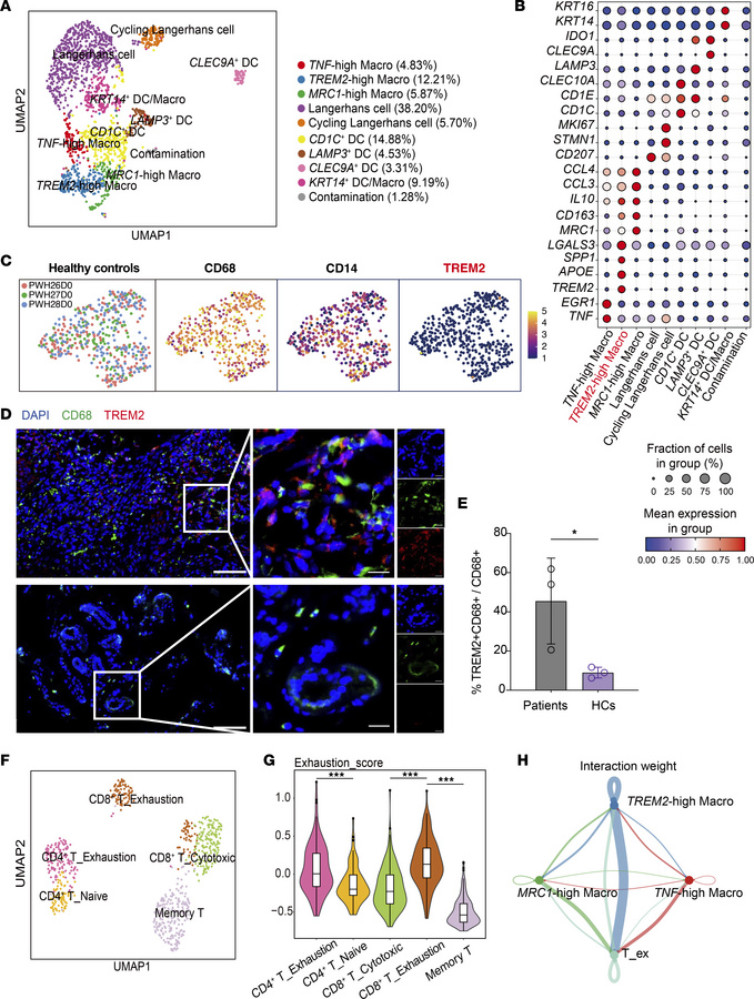 Antiinflammatory TREM2hi macrophages in lesions from a patient with CARD...
