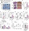 Anti-TREM2 antibody improves the antifungal immune response in vivo and in