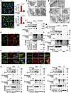 DHN induces the formation of STING aggregates to recruit caspase-8 and GSDM
