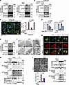 DHN-caused ER acid environment promotes the formation of STING aggregates.