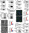 DHN-induced phosphorylation of STING by PERK facilitates the polymerization