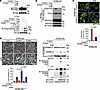 Phosphorylation of STING at Ser345 and Ser358 by PERK is critical for DHN-i