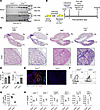 Dysregulated complement activation promotes CLAD in a mouse LTx model.