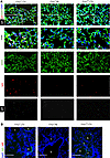 IgG deposition is more pronounced on lung allograft parenchyma from Crry-de
