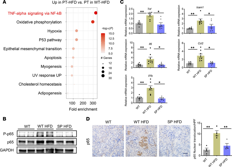 Inflammatory gene pathways are enriched in the PT-HFD cluster.
(A) Bubbl...