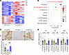 Inhibition of MAT2A modulates the tubular inflammatory phenotype in SPHFD m