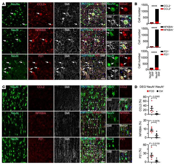 Candidate marker genes for histopathological dysmorphic neurons in drug-...