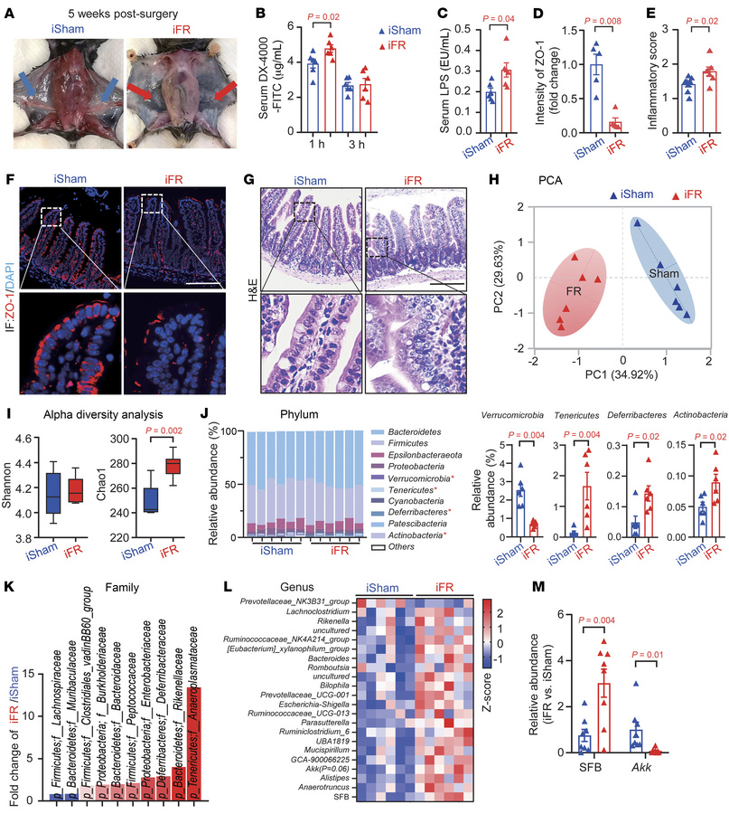 Inguinal subcutaneous white adipose tissue (iWAT) removal alters intesti...