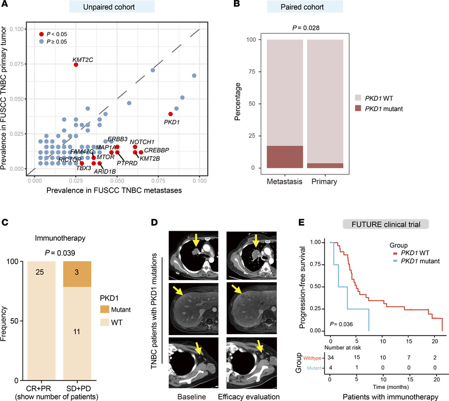 Genomic profiling of TNBC metastases identifies PKD1 as a potential biom...