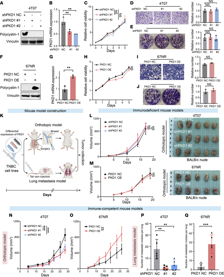 PKD1 expression facilitates tumor immune evasion.
(A and B) PKD1 knockdo...