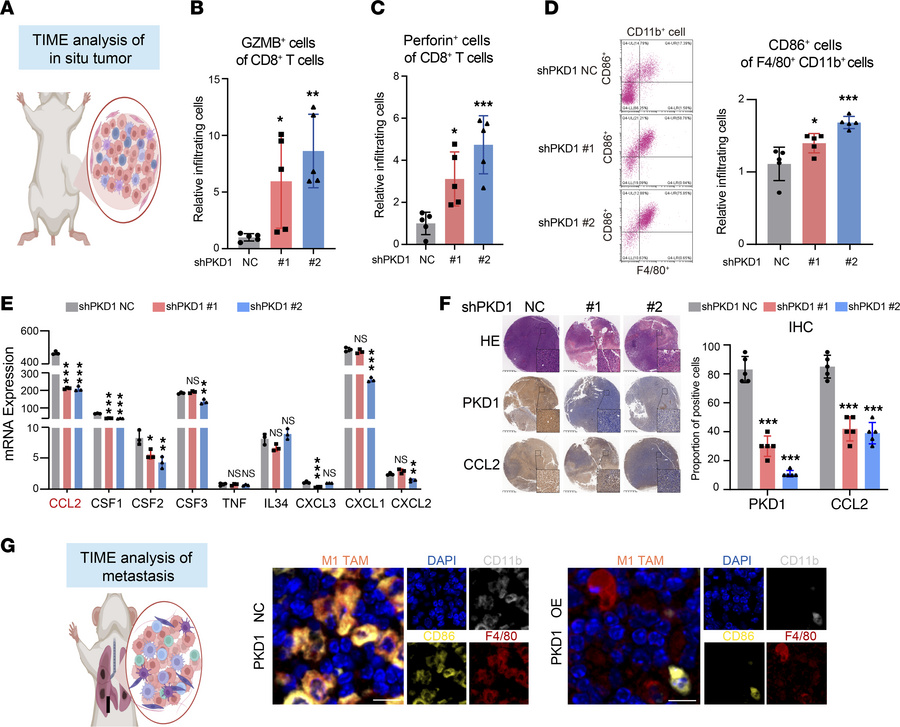 PKD1 promotes an immunosuppressive tumor microenvironment in TNBC.
(A) S...